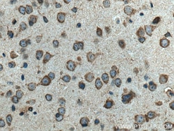 TRAP1 Mouse Monoclonal Antibody, Proteintech Unconjugated; 20 &mu;L:Antibodies,
