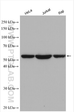 TRIM27 Rabbit Polyclonal Antibody, Proteintech Unconjugated; 20 &mu;L:Anticuerpos