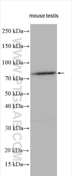 TRIM36 Rabbit Polyclonal Antibody, Proteintech Unconjugated; 20 &mu;L:Antibodies,