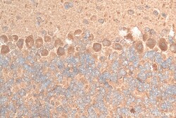 TRIM69 Rabbit Polyclonal Antibody, Proteintech Unconjugated; 20 &mu;L:Antibodies,