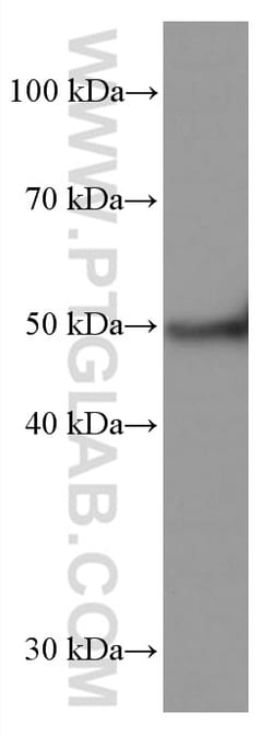 TRIM72 Mouse Monoclonal Antibody, Proteintech Unconjugated; 20 &mu;L:Antibodies,
