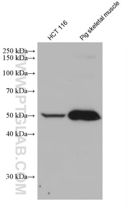 TRIM72 Mouse Monoclonal Antibody, Proteintech Unconjugated; 20 &mu;L:Antibodies,