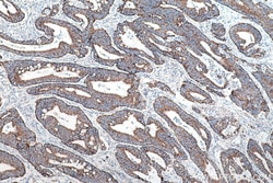 TRMT10C Rabbit Polyclonal Antibody, Proteintech:Antibodies:Primary Antibodies