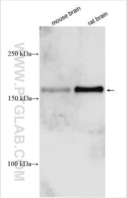 TRPM3 Rabbit Polyclonal Antibody, Proteintech Unconjugated; 150 &mu;L:Antibodies,