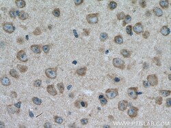 TRPM4 Rabbit Polyclonal Antibody, Proteintech Unconjugated; 20 &mu;L:Antibodies,