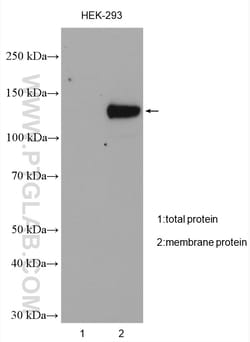 TRPM4 Rabbit Polyclonal Antibody, Proteintech Unconjugated; 20 &mu;L:Antibodies,