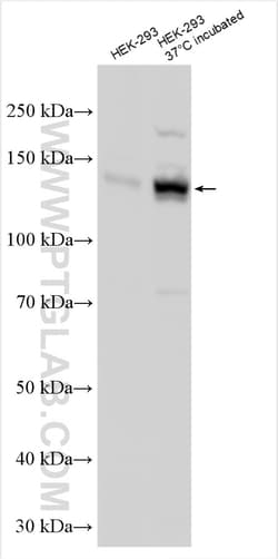 TRPM4 Rabbit Polyclonal Antibody, Proteintech Unconjugated; 20 &mu;L:Antibodies,
