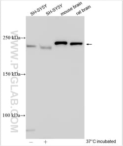 TRPM7 Rabbit Polyclonal Antibody, Proteintech