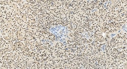 TRPS1 Rabbit Polyclonal Antibody, Proteintech:Antibodies:Primary Antibodies