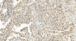 TRPS1 Rabbit Polyclonal Antibody, Proteintech:Antibodies:Primary Antibodies