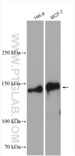 TRPS1 Rabbit Polyclonal Antibody, Proteintech:Antibodies:Primary Antibodies