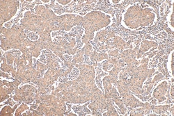 TRPV3 Rabbit Polyclonal Antibody, Proteintech