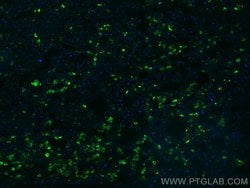 TSH Beta Mouse anti-Human, CoraLite 488, Clone: 2G1H3, Proteintech