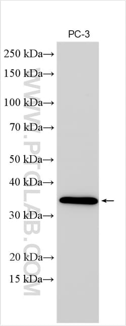 TSPAN13 Rabbit Polyclonal Antibody, Proteintech Unconjugated; 150 &mu;L:Antibodies,
