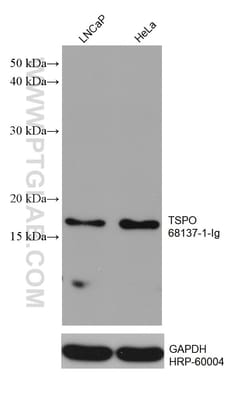 TSPO/PBR Mouse Monoclonal Antibody, Proteintech Unconjugated; 20 &mu;L:Antibodies,