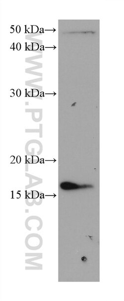 TSPO/PBR Mouse Monoclonal Antibody, Proteintech Unconjugated; 20 &mu;L:Antibodies,