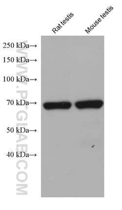 TTC30A Mouse Monoclonal Antibody, Proteintech Unconjugated; 150 &mu;L:Antibodies,