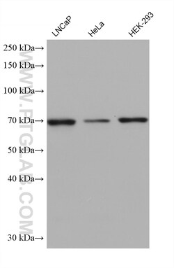 TTC30A Mouse Monoclonal Antibody, Proteintech Unconjugated; 150 &mu;L:Antibodies,
