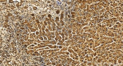 TTDN1 Rabbit Polyclonal Antibody, Proteintech Unconjugated; 20 &mu;L:Antibodies,