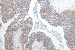 TTLL12 Mouse Monoclonal Antibody, Proteintech:Antibodies:Primary Antibodies