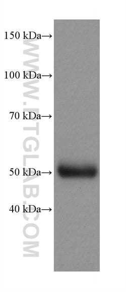 TTYH1 Rabbit Recombinant Antibody, Proteintech Unconjugated; 20 &mu;L:Antibodies,