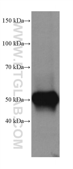 TTYH1 Rabbit Recombinant Antibody, Proteintech Unconjugated; 20 &mu;L:Antibodies,