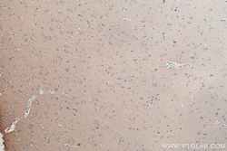 Beta Tubulin Rabbit Polyclonal Antibody, Proteintech:Antibodies:Primary