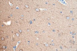 Beta Tubulin Rabbit Polyclonal Antibody, Proteintech:Antibodies:Primary