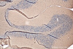 Beta Tubulin Rabbit Polyclonal Antibody, Proteintech:Antibodies:Primary