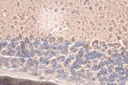 Beta Tubulin Rabbit Polyclonal Antibody, Proteintech:Antibodies:Primary