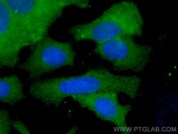TWF1 Mouse Monoclonal Antibody, Proteintech Unconjugated; 20 &mu;L:Antibodies,