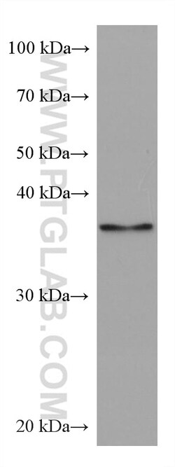 TWF1 Mouse Monoclonal Antibody, Proteintech Unconjugated; 20 &mu;L:Antibodies,