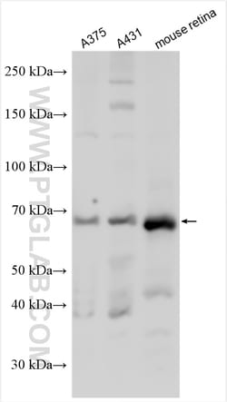 TRP1 Rabbit Polyclonal Antibody, Proteintech:Anticorps:Anticorps primaires