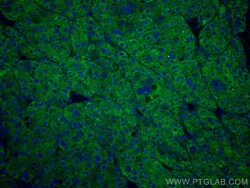 CoraLite Plus 488-conjugated Transferrin/TF Mouse Monoclonal Antibody,