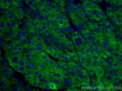 CoraLite Plus 488-conjugated Transferrin/TF Mouse Monoclonal Antibody,