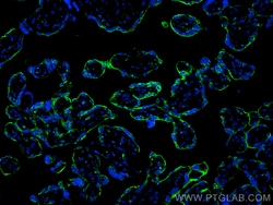 CoraLite Plus 488-conjugated Transferrin/TF Mouse Monoclonal Antibody,