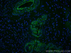 CoraLite Plus 488-conjugated Transgelin 2 Mouse Monoclonal Antibody, Proteintech