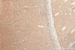 TrkB Rabbit anti-Human, Mouse, Rat, Polyclonal, Proteintech 150 &mu;L;