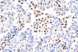 FAT10 Rabbit Polyclonal Antibody, Proteintech Unconjugated; 20 &mu;L:Antibodies,