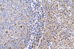 FAT10 Rabbit Polyclonal Antibody, Proteintech Unconjugated; 20 &mu;L:Antibodies,