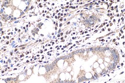 FAT10 Rabbit Polyclonal Antibody, Proteintech Unconjugated; 20 &mu;L:Antibodies,