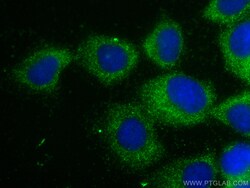 UBE2D1/2/3/4 Mouse Monoclonal Antibody, Proteintech:Anticorps:Anticorps
