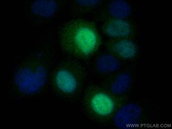 UBE2S Rabbit Recombinant Antibody, Proteintech Unconjugated; 20 &mu;L:Antibodies,