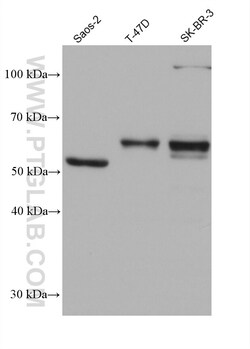 UBOX5 Mouse Monoclonal Antibody, Proteintech Unconjugated; 20 &mu;L:Antibodies,
