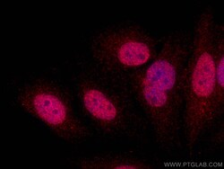 UHRF2 Rabbit Polyclonal Antibody, Proteintech 150 &mu;L | Buy Online | Proteintech | Fisher Scientific
