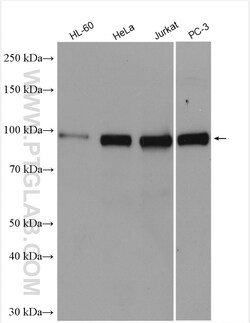 UHRF2 Rabbit Polyclonal Antibody, Proteintech 150 &mu;L | Buy Online | Proteintech | Fisher Scientific