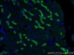 Uromodulin Rabbit Polyclonal Antibody, Proteintech:Antibodies:Primary Antibodies
