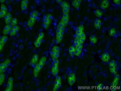 Uromodulin Rabbit Polyclonal Antibody, Proteintech:Antibodies:Primary Antibodies