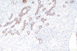 Uromodulin Rabbit Polyclonal Antibody, Proteintech:Antibodies:Primary Antibodies