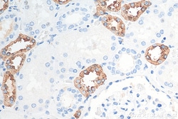 Uromodulin Rabbit Polyclonal Antibody, Proteintech:Antibodies:Primary Antibodies